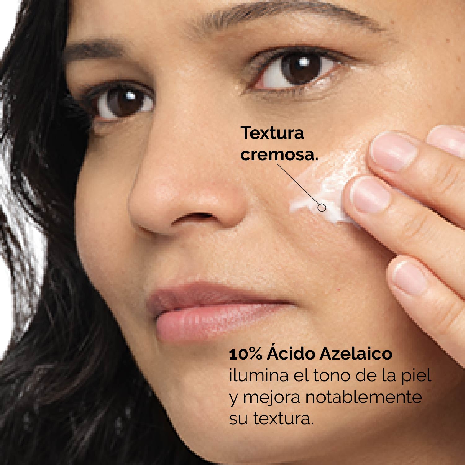 AZELAIC ACID SUSPENSION 10% (SUSPENSIÓN ILUMINADORA CON ÁCIDO AZELAICO )